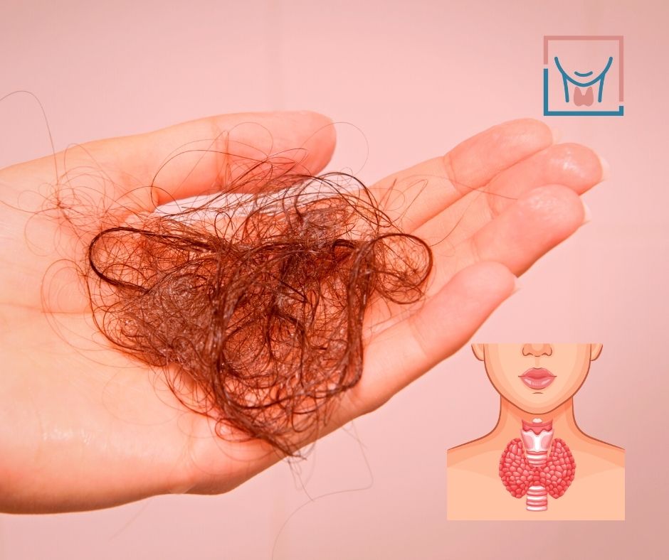 Thyroid & Hair Loss — Causes and Treatment